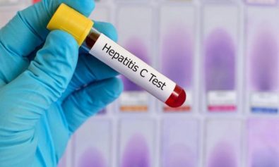 hepatita C